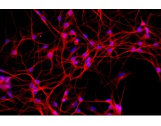 小鼠原代細(xì)胞