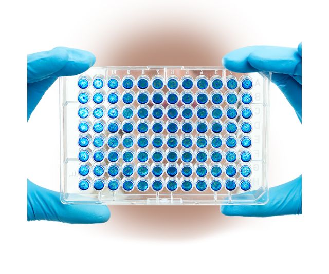 elisa 酶聯(lián)免疫吸附實(shí)驗(yàn)